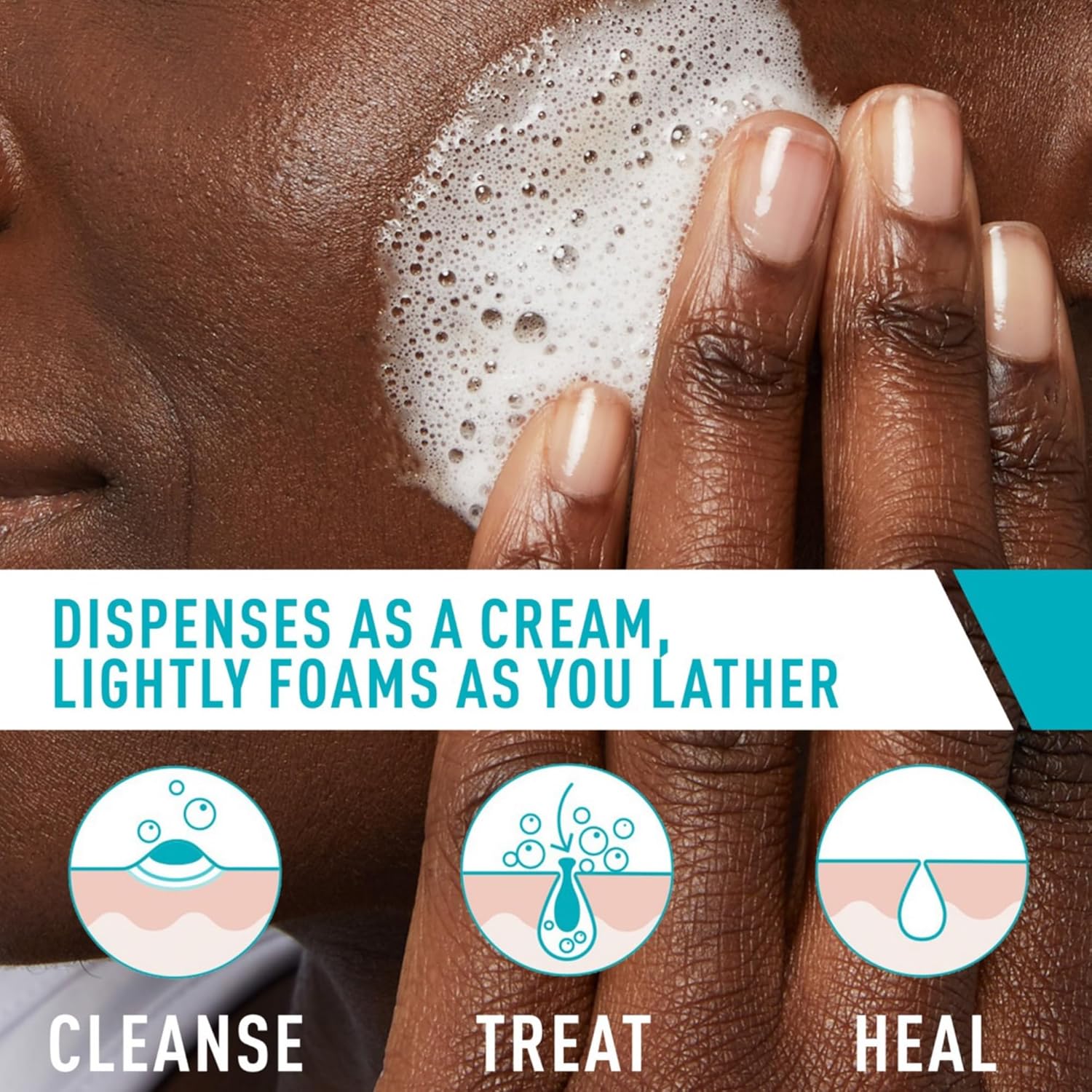 Cerave Acne Foaming Cream Cleanser-150ml thumbnail 7